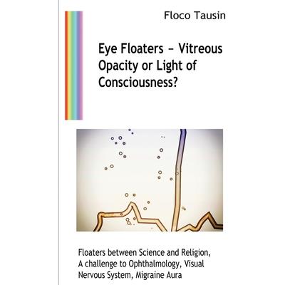 Eye Floaters - Vitreous Opacity or Light of Consciousness? | 拾書所