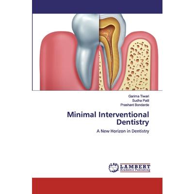 Minimal Interventional Dentistry