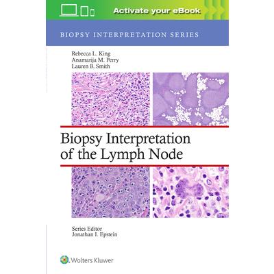 Biopsy Interpretation of the Lymph Node | 拾書所