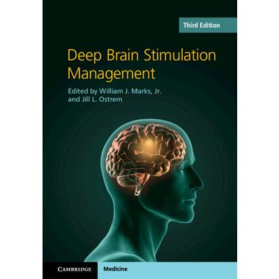 Deep Brain Stimulation Management