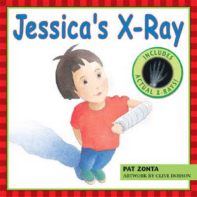 Jessica’s X-Ray