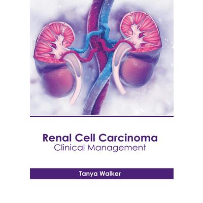 Renal Cell Carcinoma: Clinical Management