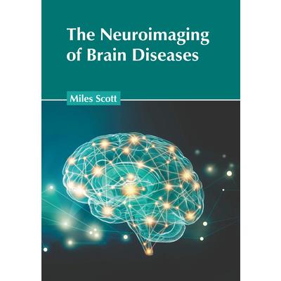 The Neuroimaging of Brain Diseases | 拾書所