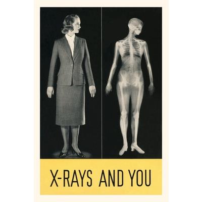 Vintage Journal X-Rays and You