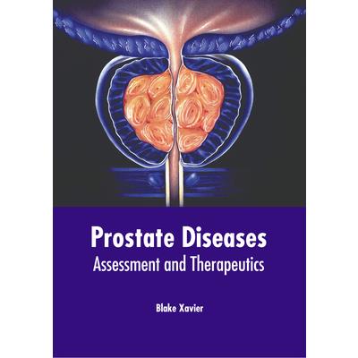 Prostate Diseases: Assessment and Therapeutics | 拾書所