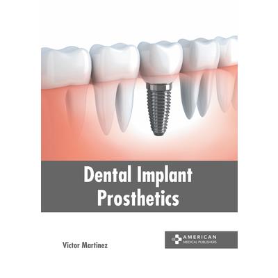 Dental Implant Prosthetics | 拾書所