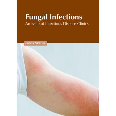 Fungal Infections: An Issue of Infectious Disease Clinics | 拾書所