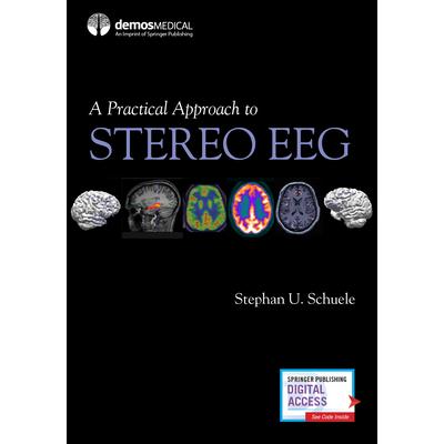 A Practical Approach to Stereo Eeg