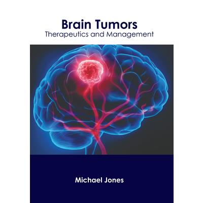 Brain Tumors: Therapeutics and Management | 拾書所