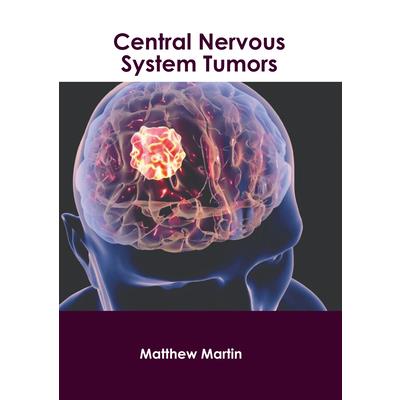 Central Nervous System Tumors | 拾書所